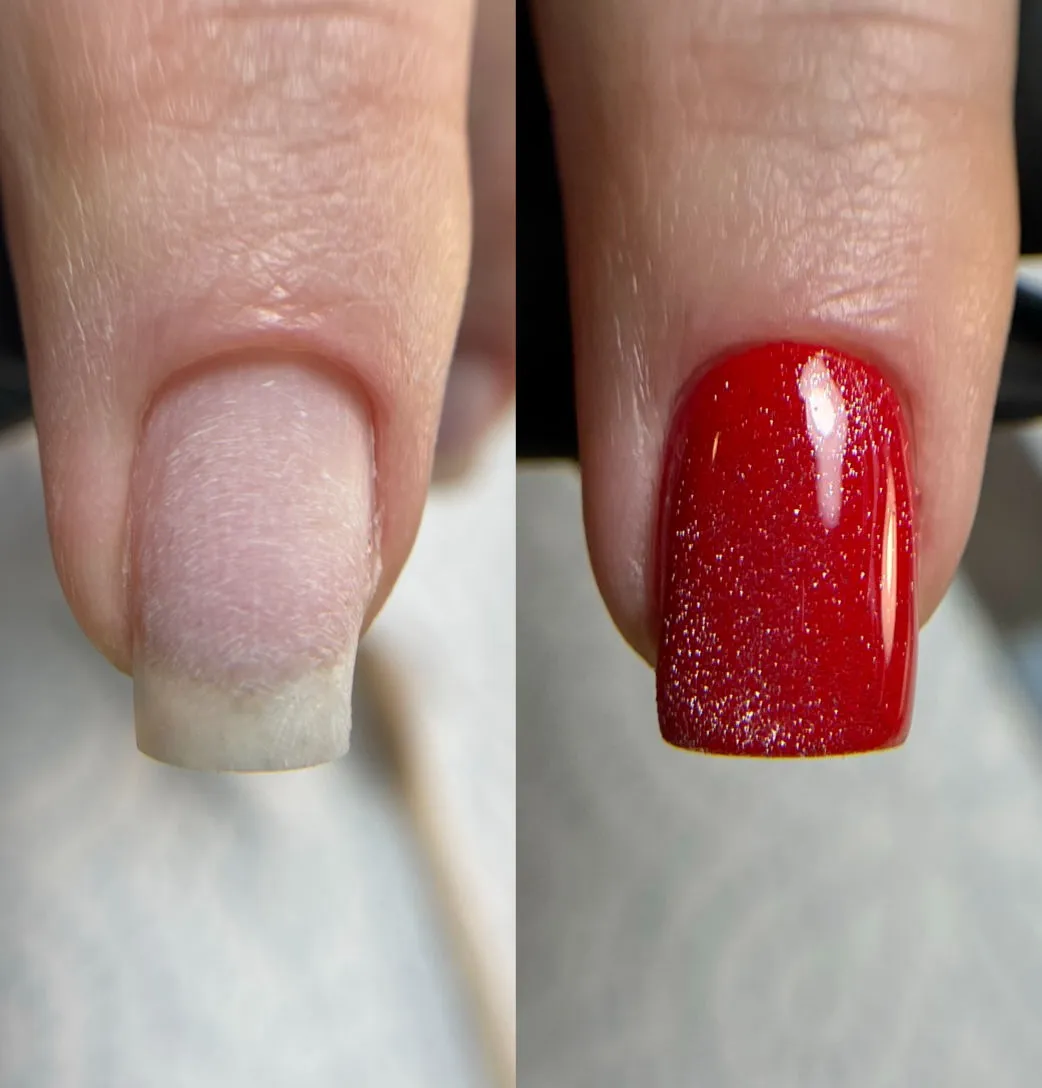 Nail Fix - Per Nail